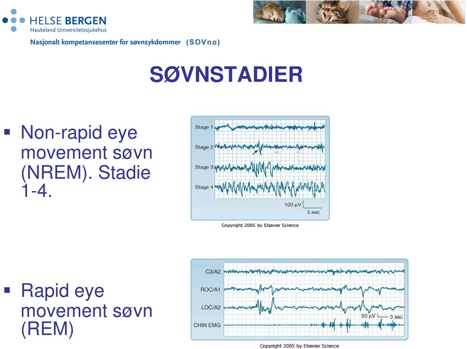 (NREM). Stadie 1-4.