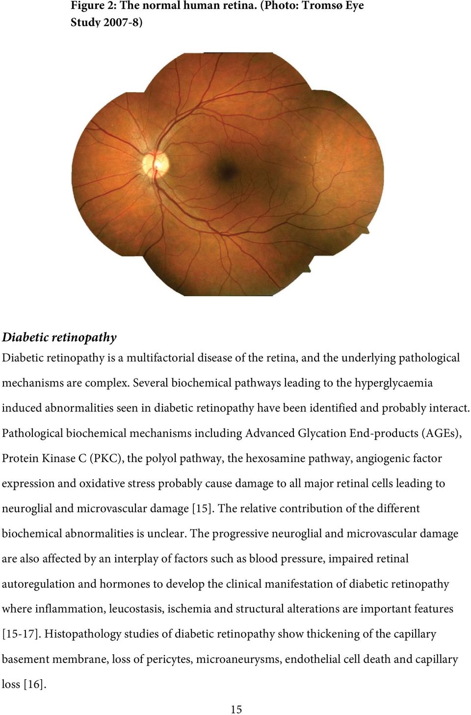 Several biohemial pathways leading to the hyperglyaemia indued abnormalities seen in diabeti retinopathy have been identified and probably interat.