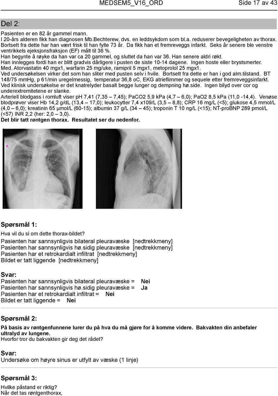 sidig pleuravæske [nedtrekkmeny] Pasienten har et retrokardialt infiltrat [nedtrekkmeny] Bildet er tatt liggende [nedtrekkmeny] Pasienten har sannsynligvis bilateral pleuravæske = Pasienten har