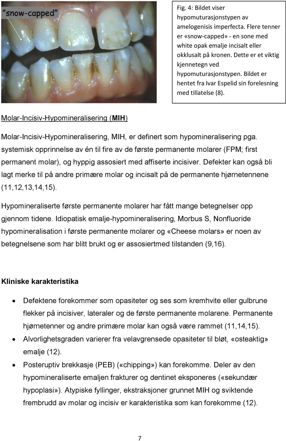 Molar-Incisiv-Hypomineralisering (MIH) Molar-Incisiv-Hypomineralisering, MIH, er definert som hypomineralisering pga.