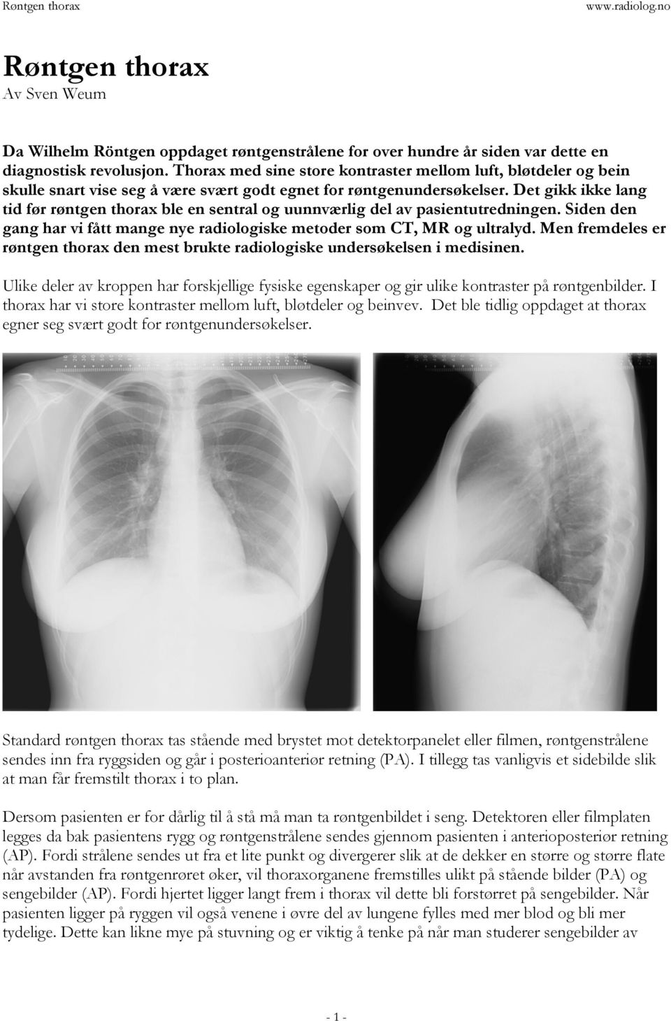 Det gikk ikke lang tid før røntgen thorax ble en sentral og uunnværlig del av pasientutredningen. Siden den gang har vi fått mange nye radiologiske metoder som CT, MR og ultralyd.