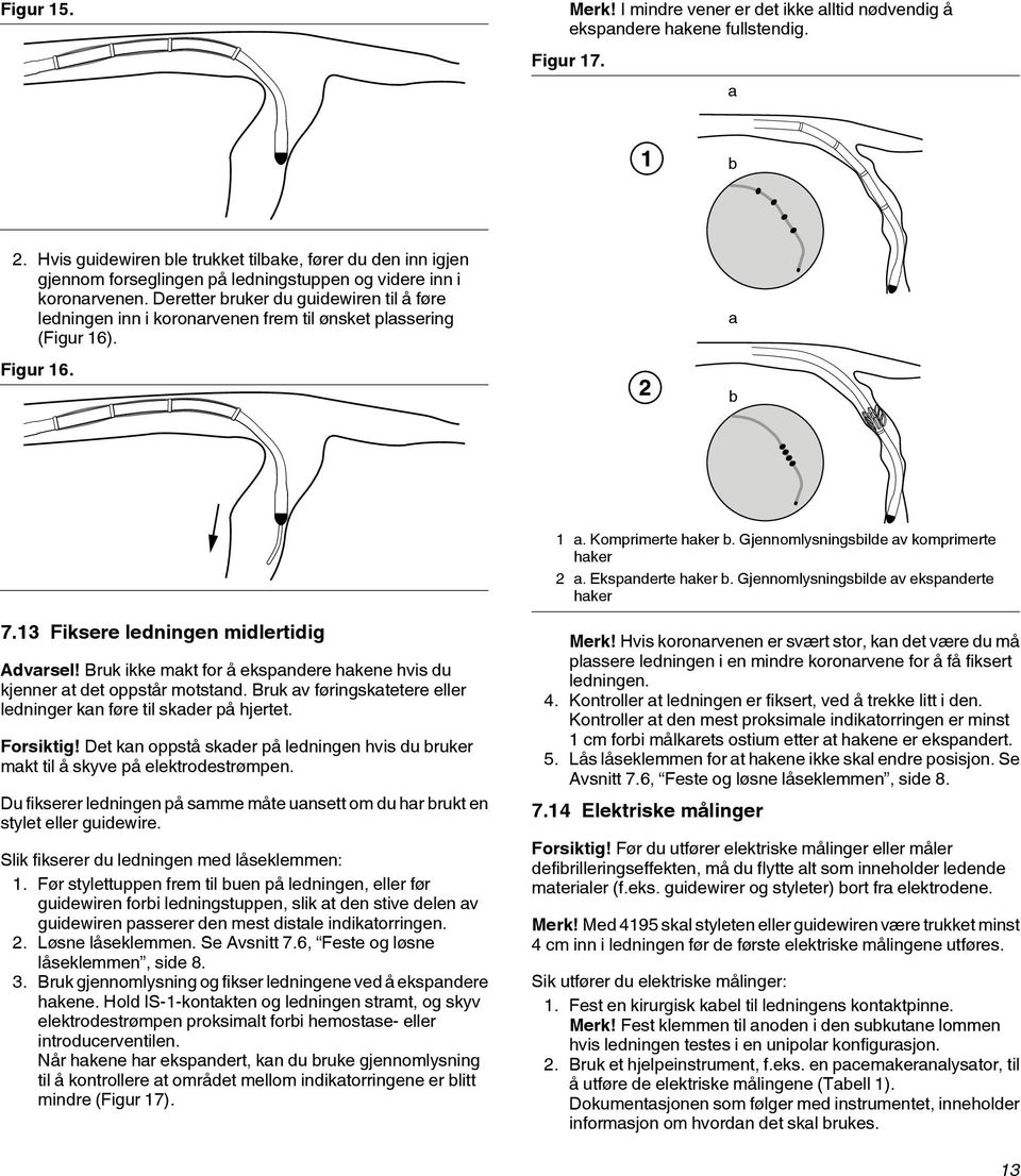 Deretter bruker du guidewiren til å føre ledningen inn i koronarvenen frem til ønsket plassering (Figur 16). Figur 16. a b 1 a. Komprimerte haker b. Gjennomlysningsbilde av komprimerte haker 2 a.