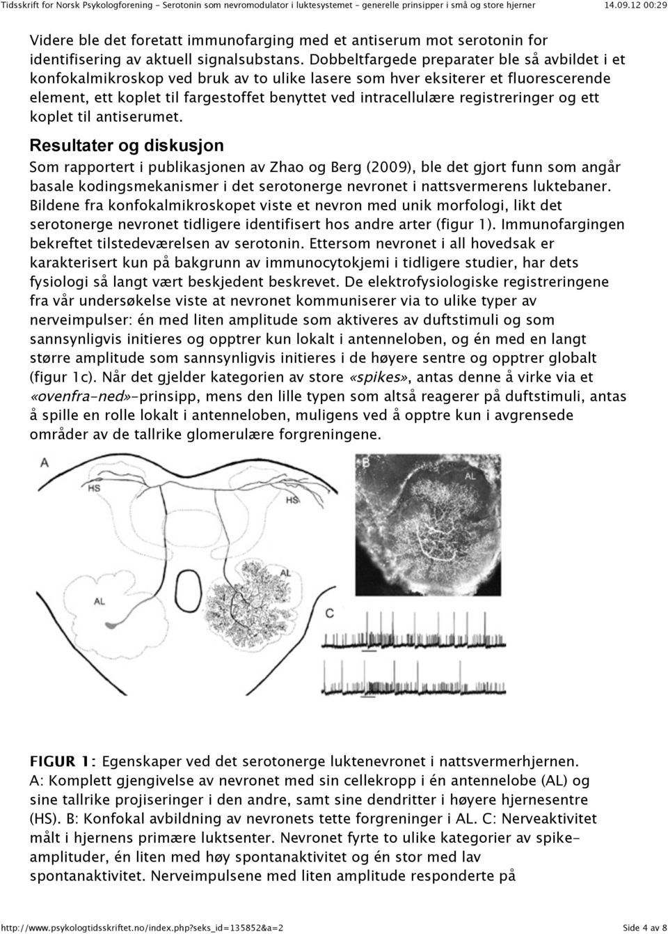 registreringer og ett koplet til antiserumet.