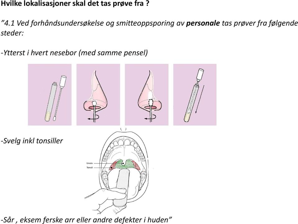 prøver fra følgende steder: -Ytterst i hvert nesebor (med samme