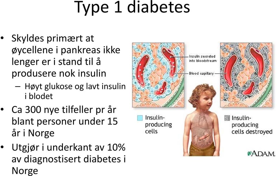 insulin i blodet Ca 300 nye tilfeller pr år blant personer under