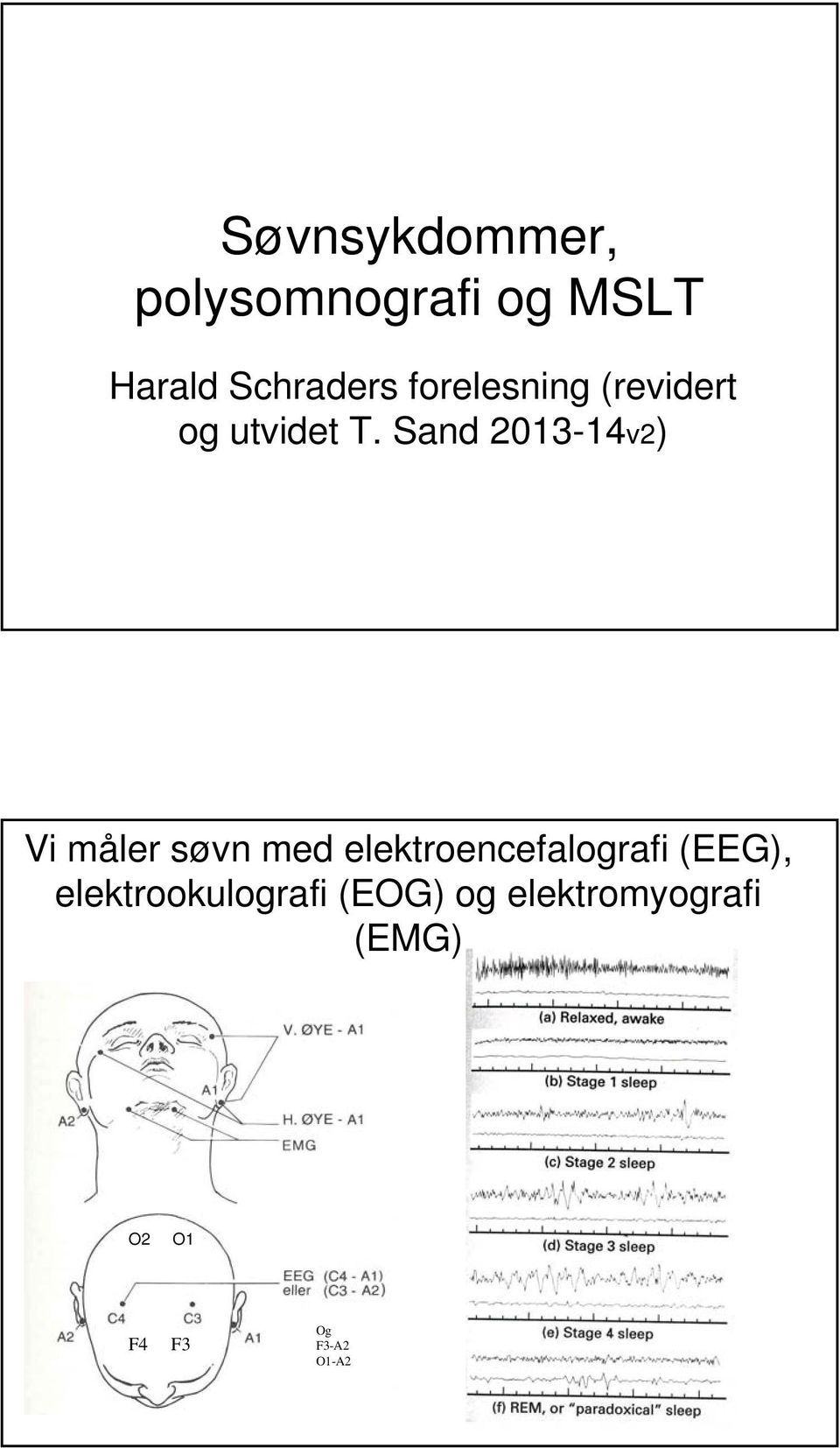 Sand 2013-14v2) Vi måler søvn med elektroencefalografi