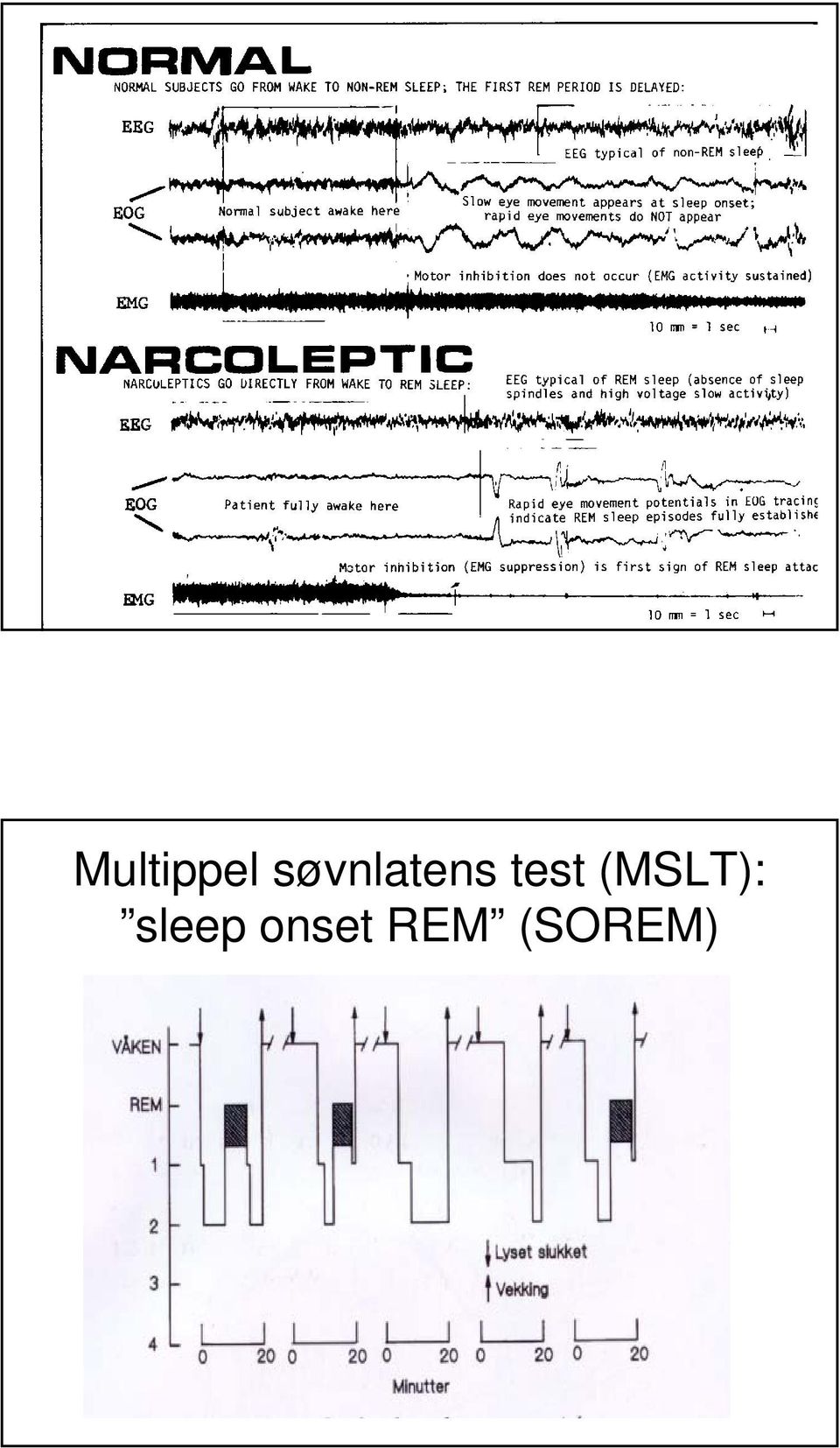 test (MSLT):
