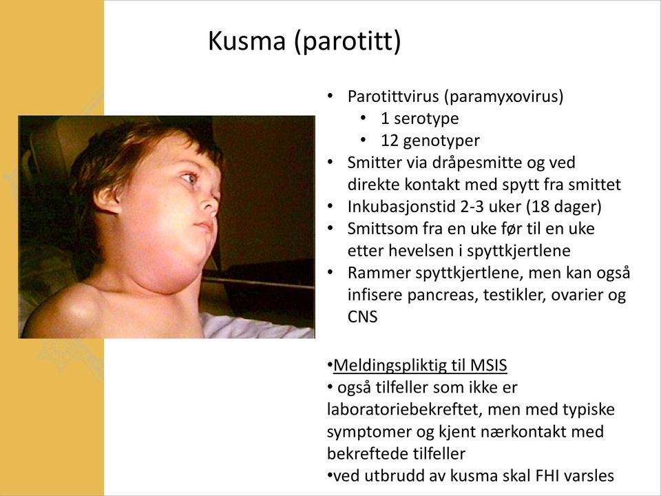 spyttkjertlene, men kan også infisere pancreas, testikler, ovarier og CNS Meldingspliktig til MSIS også tilfeller som ikke er