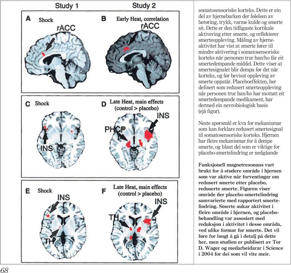 Måling av hjerneaktivitet har vist at smerte fører til mindre aktivering i somatosensoriske korteks når personen trur han/ho får eit smertedempande middel.