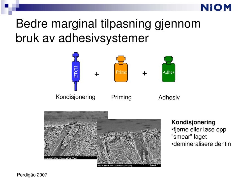 Priming Adhesiv Kondisjonering fjerne eller