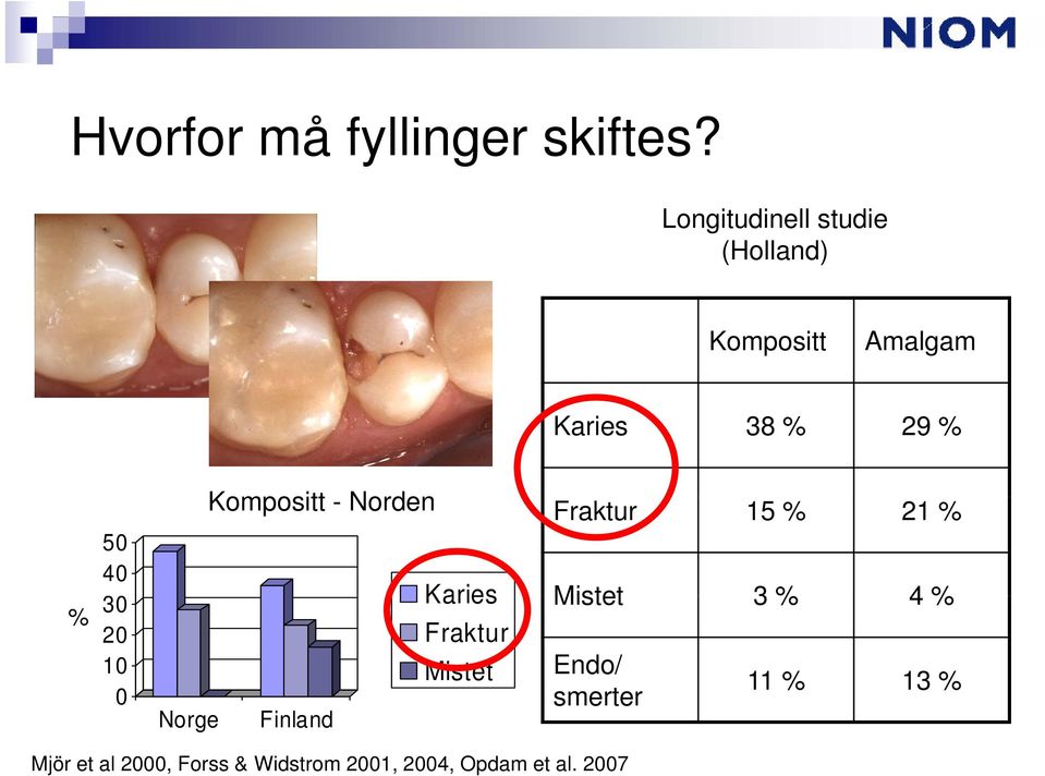 40 30 20 10 0 Kompositt - Norden Fraktur 15 % 21 % 30 Karies Fraktur
