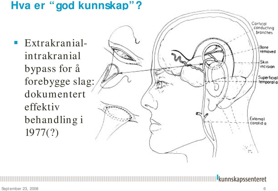 for å forebygge slag: dokumentert