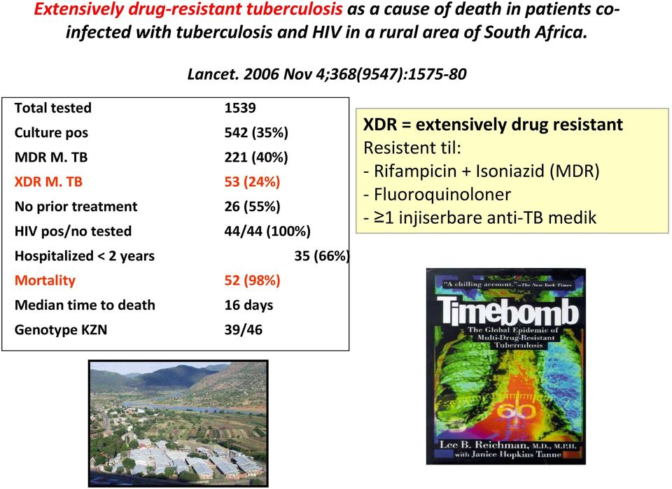 TB 53 (24%) No prior treatment 26 (55%) HIV pos/no tested 44/44 (100%) Hospitalized < 2 years 35 (66%) Mortality 52 (98%) Median time
