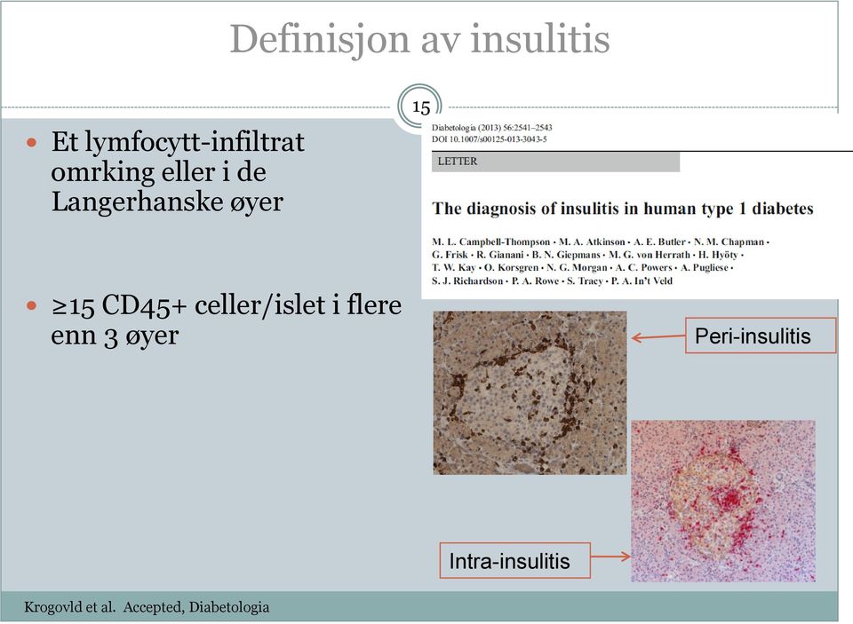 celler/islet i flere enn 3 øyer Peri-insulitis