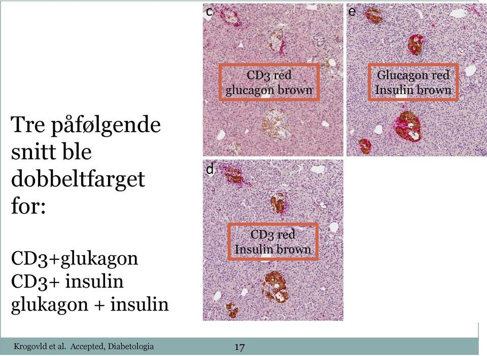 CD3+glukagon CD3+ insulin glukagon + insulin CD3