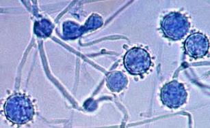 SPORADISK FUNGURI Candiduri vs.