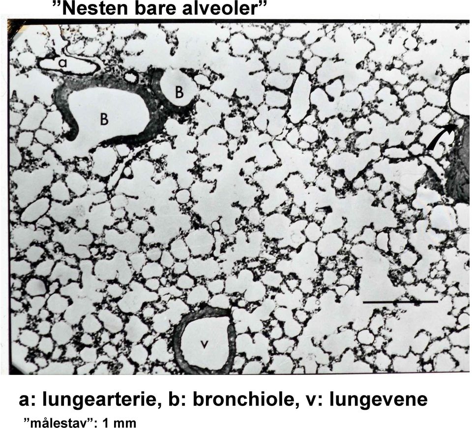 bronchiole, v: