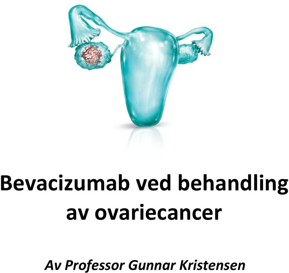 ovariecancer Av