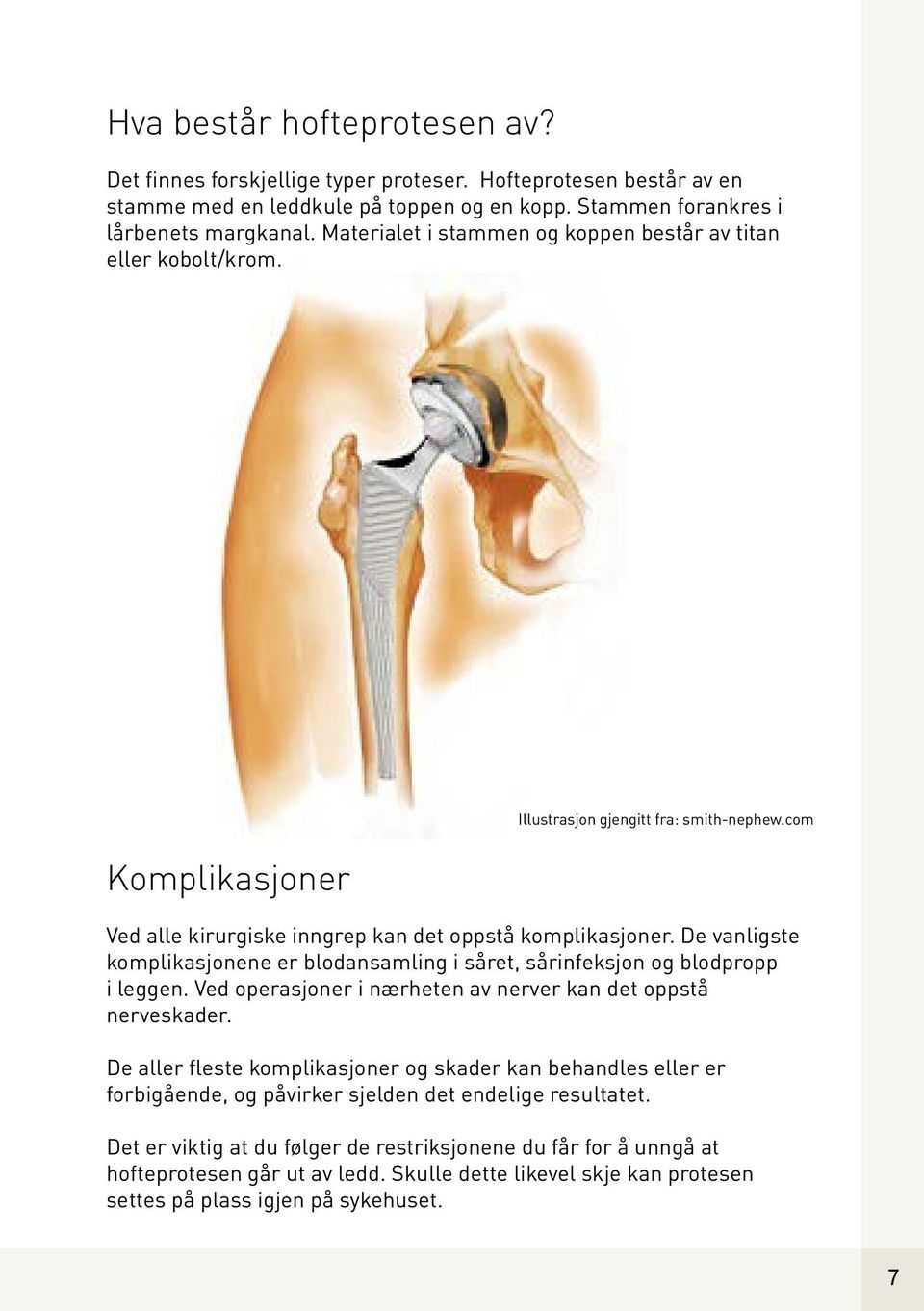 De vanligste komplikasjonene er blodansamling i såret, sårinfeksjon og blodpropp i leggen. Ved operasjoner i nærheten av nerver kan det oppstå nerveskader.