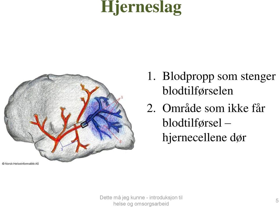 blodtilførselen 2.