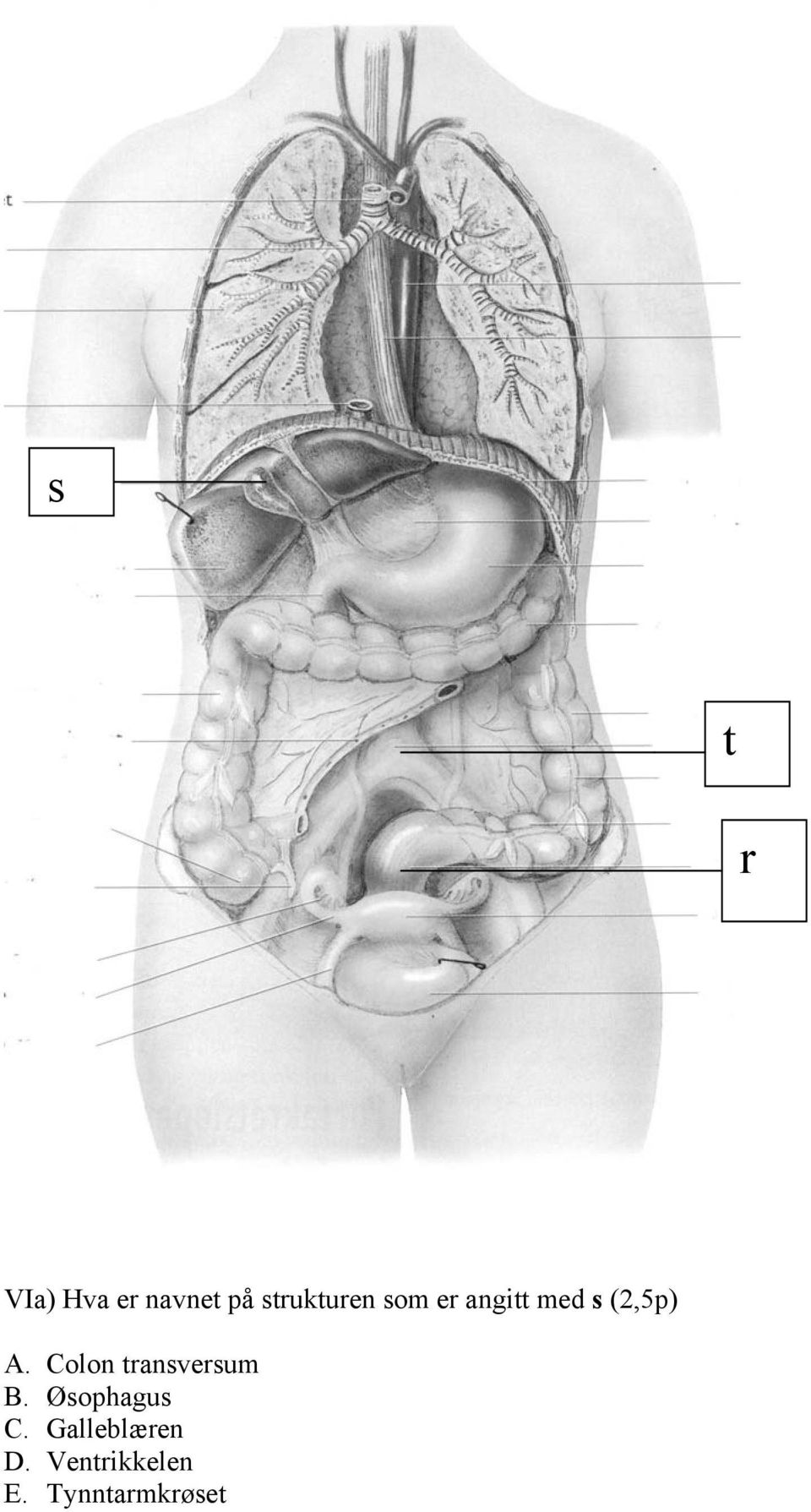 (2,5p) A. Colon transversum B.