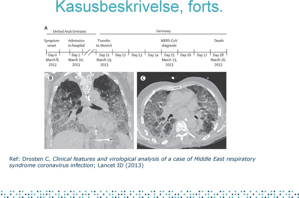 of a case of Middle East respiratory