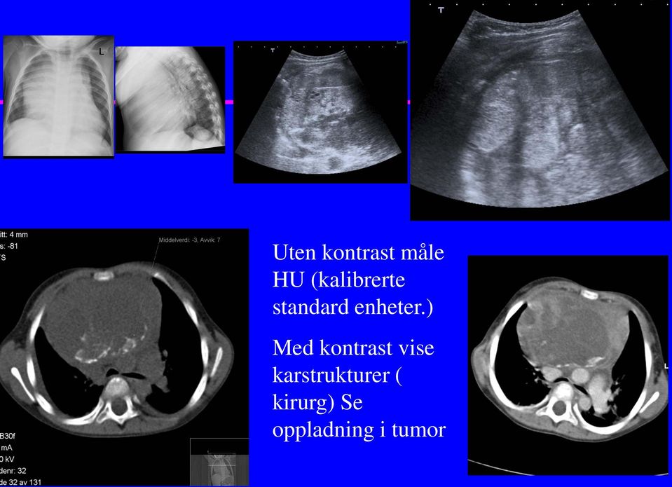 ) Med kontrast vise