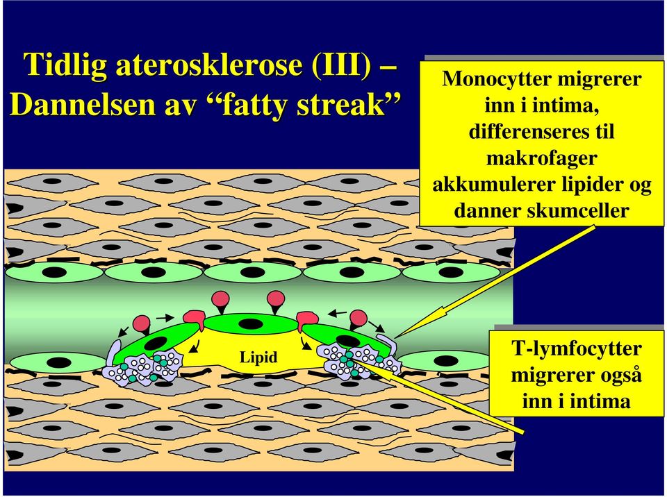 til makrofager akkumulerer lipider og og danner