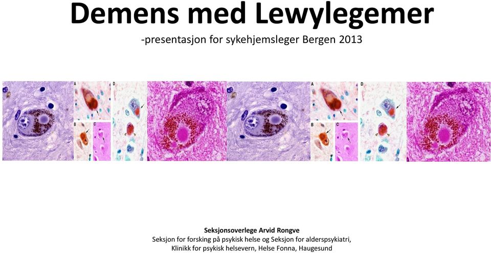 forsking på psykisk helse og Seksjon for