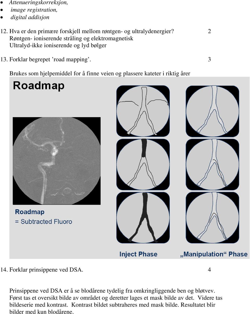 3 Brukes som hjelpemiddel for å finne veien og plassere kateter i riktig årer 14. Forklar prinsippene ved DSA.