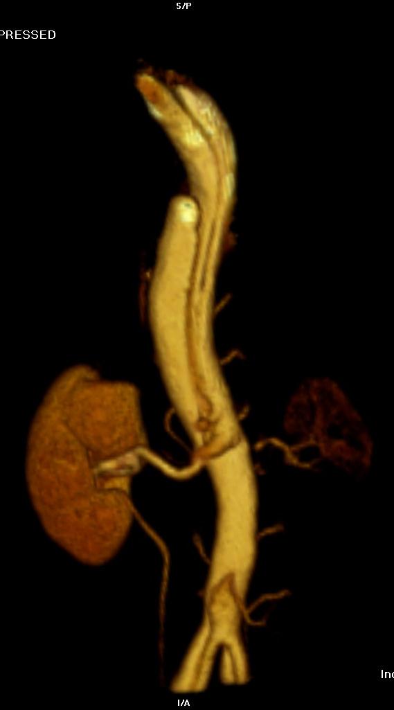 MRI / MRA Kontrast iv.