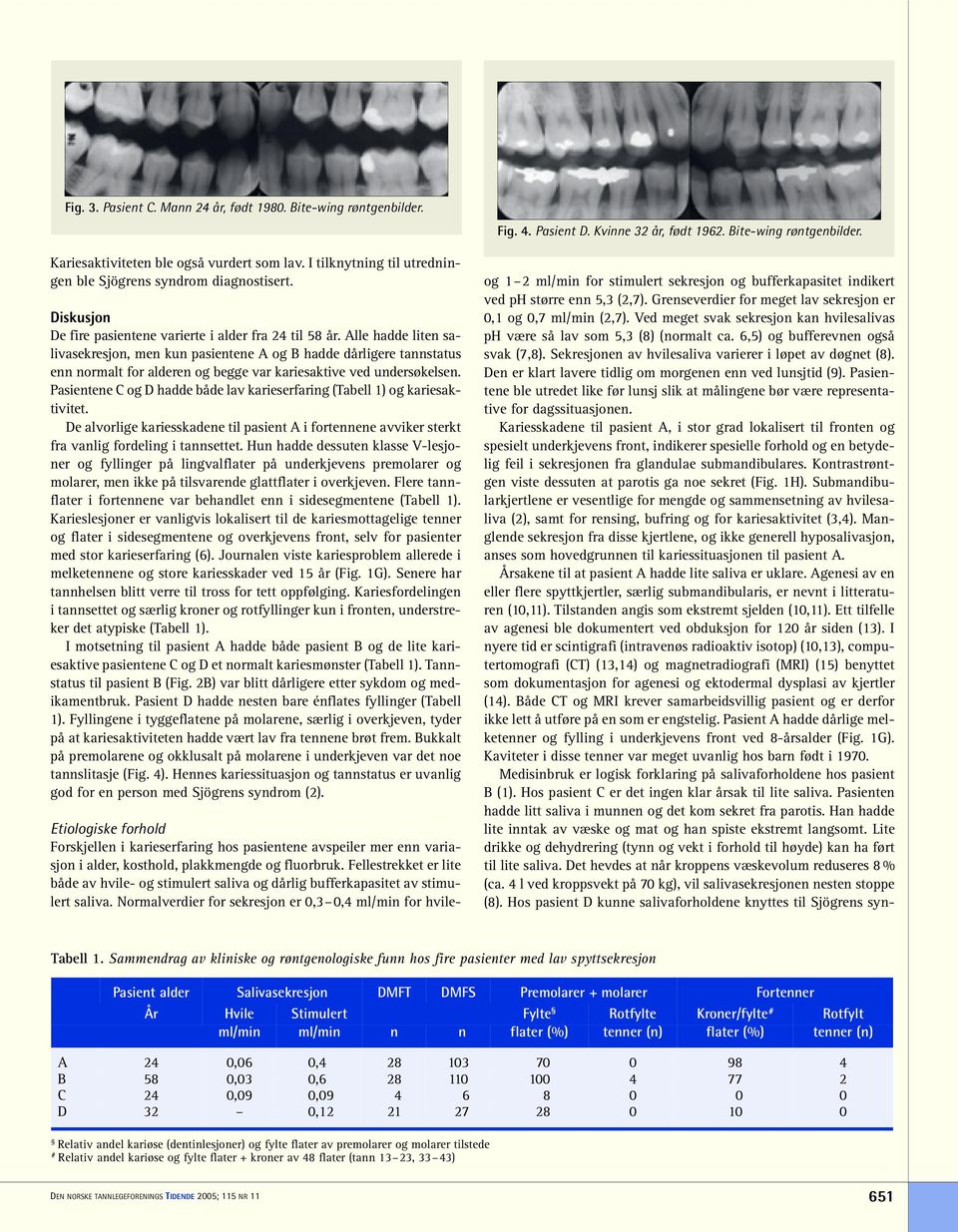 Alle hadde liten salivasekresjon, men kun pasientene A og B hadde dårligere tannstatus enn normalt for alderen og begge var kariesaktive ved undersøkelsen.