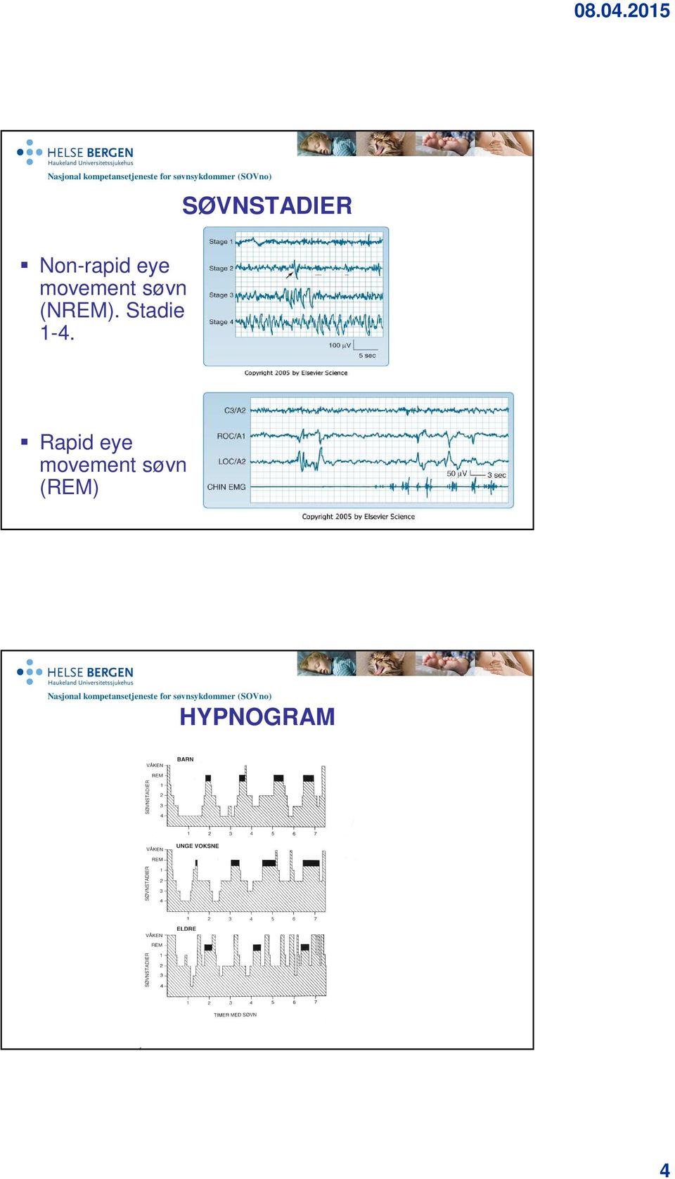 eye movement søvn (NREM).