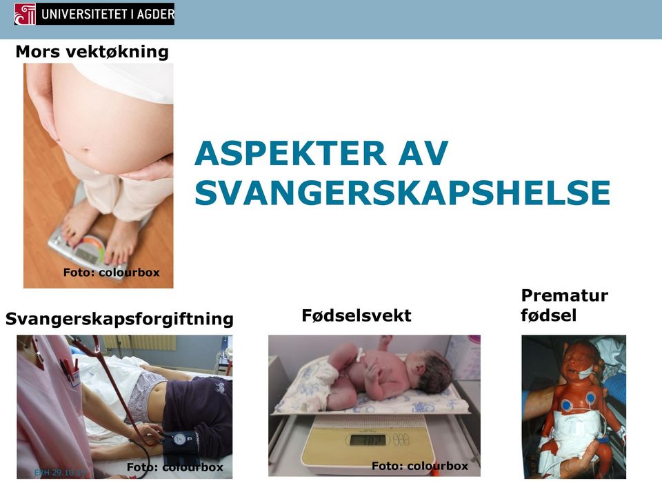 Svangerskapsforgiftning Fødselsvekt