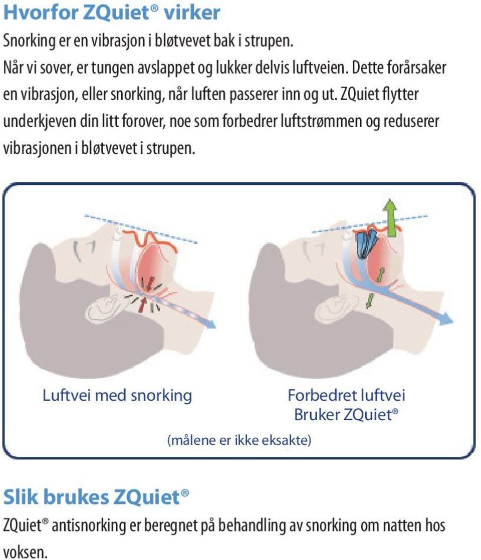 Dette forårsaker en vibrasjon, eller snorking, når luften passerer inn og ut.