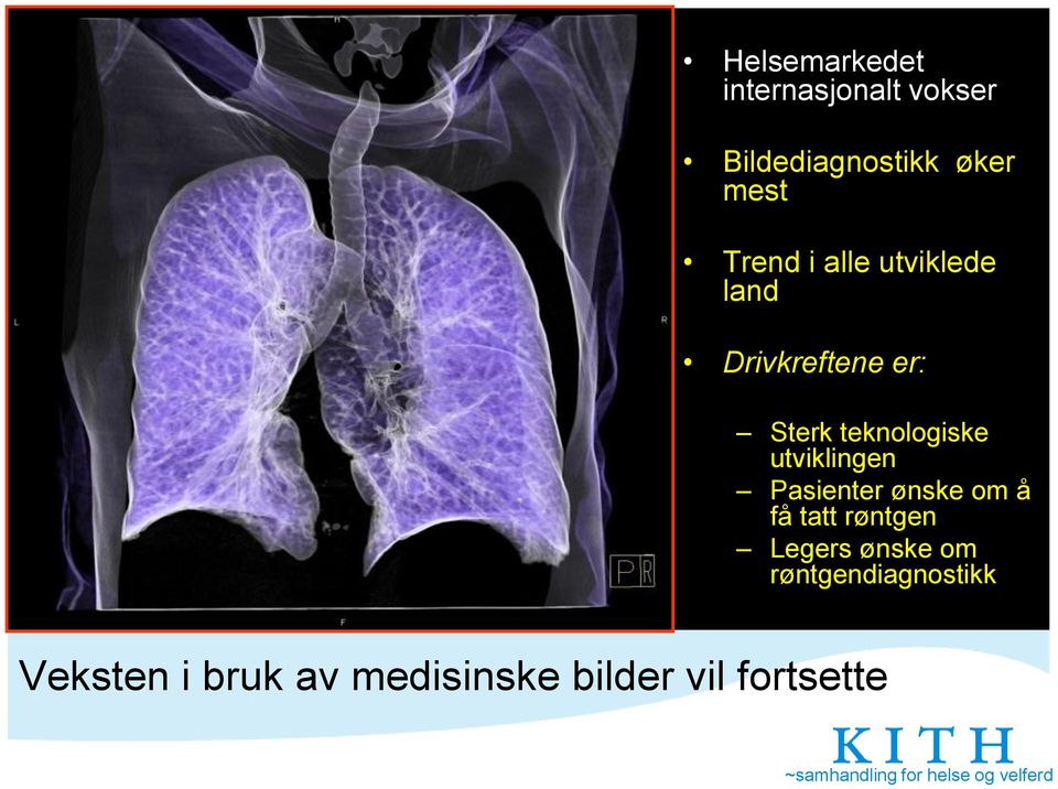 utviklingen Pasienter ønske om å få tatt røntgen Legers ønske om