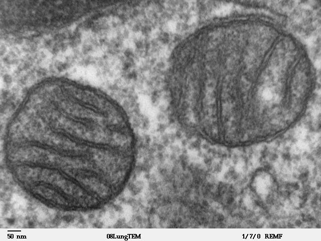 matrix Electron micrograph of a