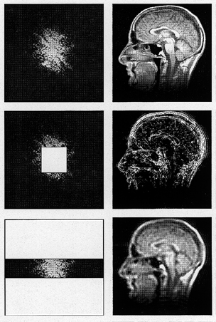 Fourier transformasjon av hele k-spacek Fourier transformasjon