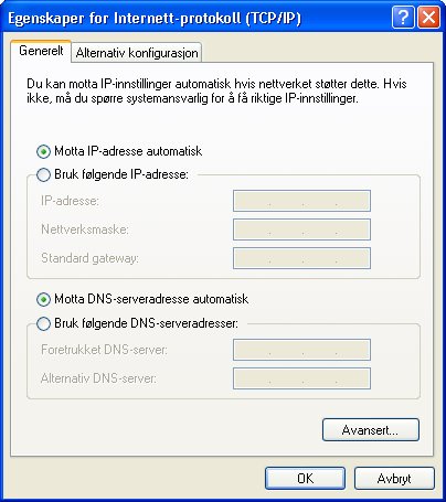 Billion BiPAC 7100SV VoIP ADSL-modem/ruter 3. I vinduet for Status for Lokal tilkobling, klikker du på Egenskaper. 4.