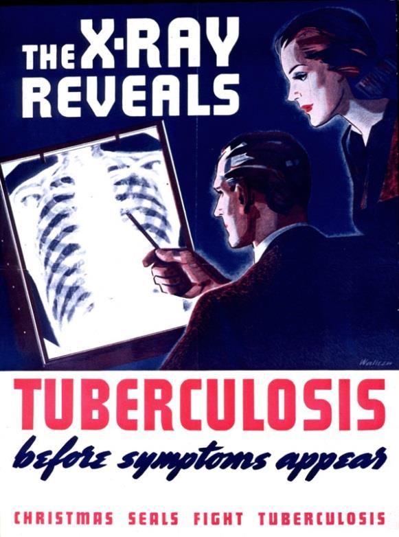 Tuberkulose De fleste er undersøkt før ankomst. Vurdering av tiltak etter skjema. Flyktningehelsesøster henviser til IGRA og RG i smittevernlegens navn.