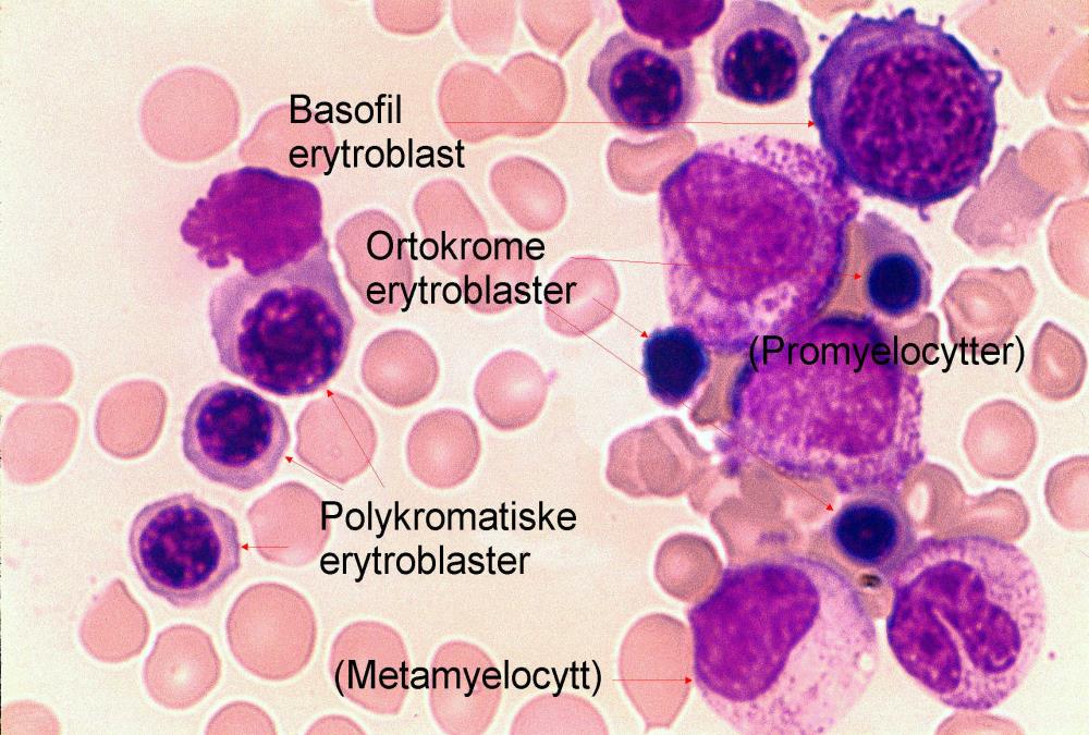 Erytroblastiske øyer Erytropoiese foregår i klynger samlet rundt en makrofag Makrofagen