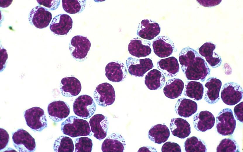 NK-celler Trombocytter (blodplater) Kjerneløse cellefragmenter Betydning for blodstansning eller hemostase Ikke bare murstein!