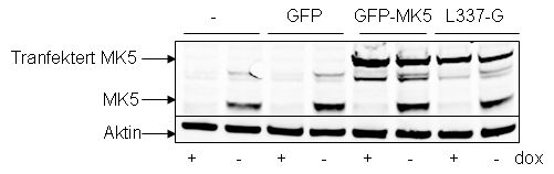 For å teste om uttrykket fusjonsprotein av mus MK5 og EGFP i Hela cellene samtidig som uttrykket av endogent MK5 ble nedregulert av shrna var vellykket, kjørte vi western blott analyse av