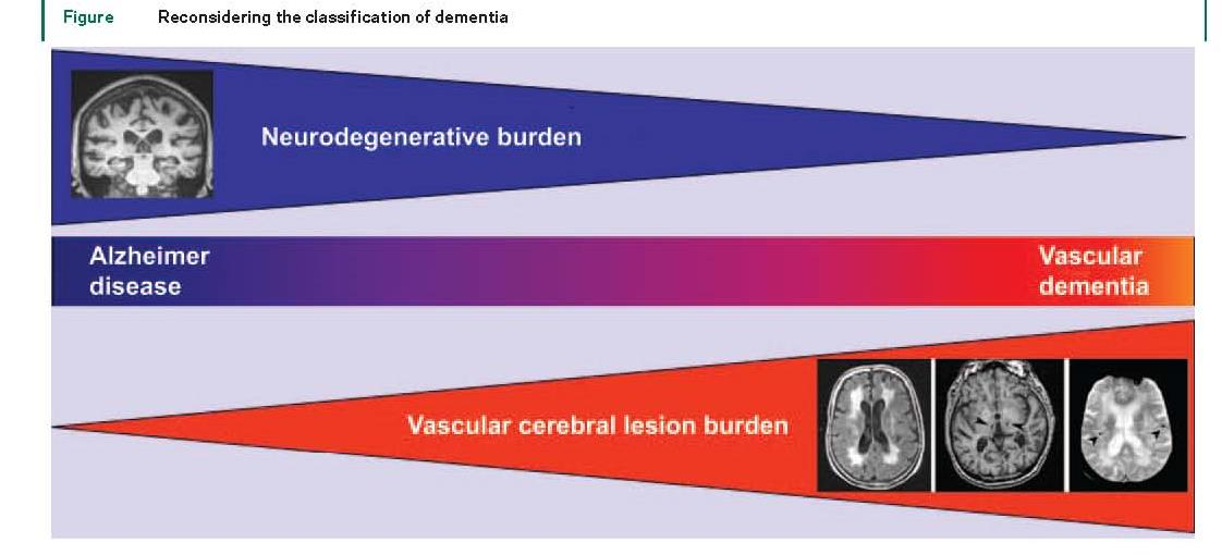 Neurodegenerasjon og vaskulær hjernesykdom