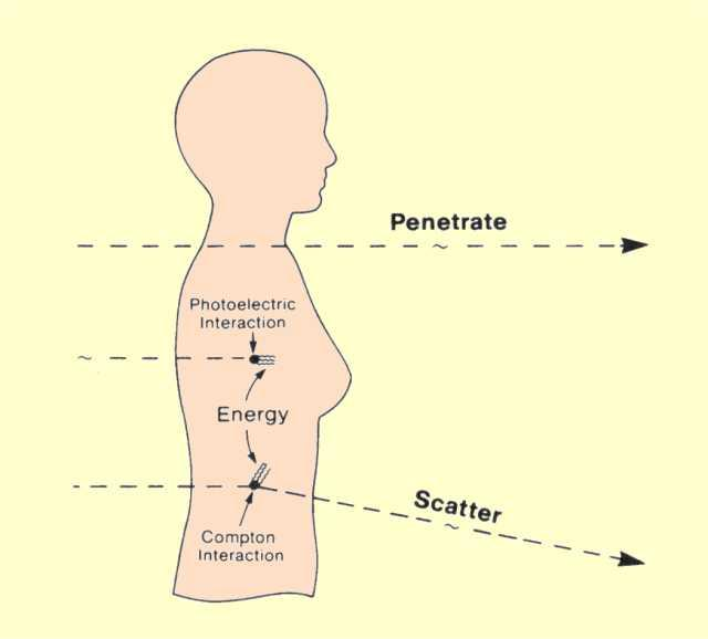 Detektor Årsaken til kontrast i bildet Stråling treffer vev (atomer) gjennom fotoelektrisk effekt og