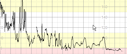 Reaktivitet / Akselerasjoner Normalt reaktiv CTG: >2 akselerasjoner /20 min Preterminalt: Ingen variabilitet (2 slag/min) og reaktivitet med eller uten deselerasjoner eller bradykardi CTG (FIGO)