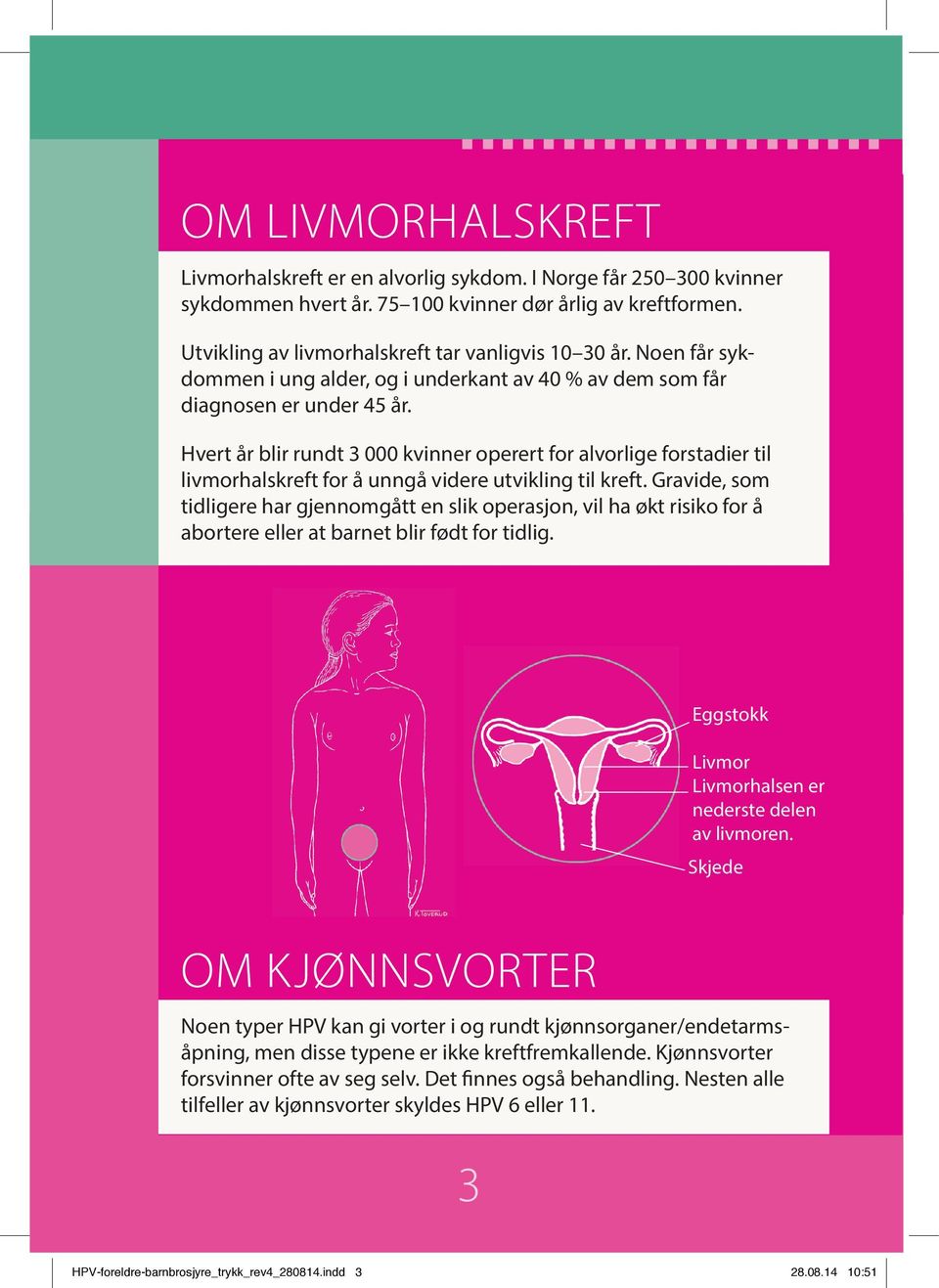 Hvert år blir rundt 3 000 kvinner operert for alvorlige for stadier til livmorhalskreft for å unngå videre utvikling til kreft.