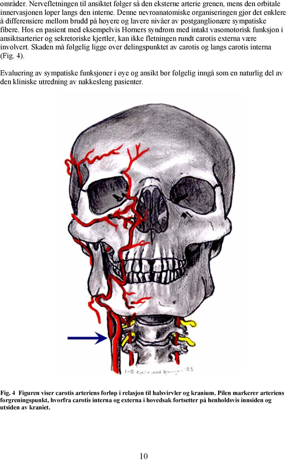 Hos en pasient med eksempelvis Horners syndrom med intakt vasomotorisk funksjon i ansiktsarterier og sekretoriske kjertler, kan ikke fletningen rundt carotis externa være involvert.