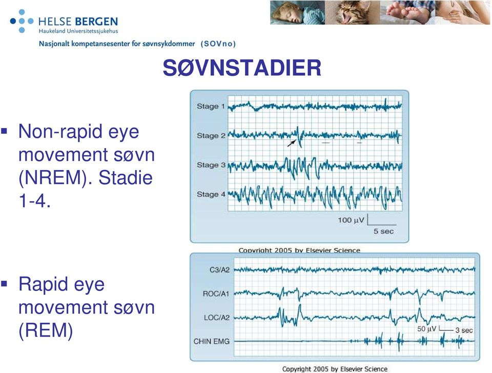 (NREM). Stadie 1-4.