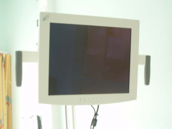Utstyr Felles TV/DVD/PC skjerm: Beregnet for rengjøring med kjemikalier Pasienten styrer dette selv med fjernkontroll.